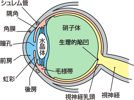 前房出血